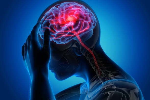 Brain treatment in basti